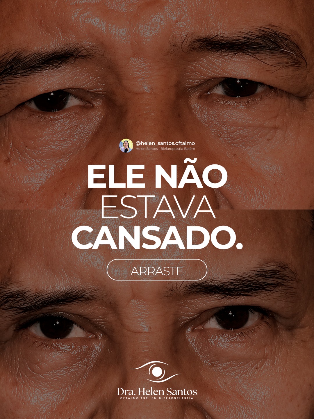 Peça 1