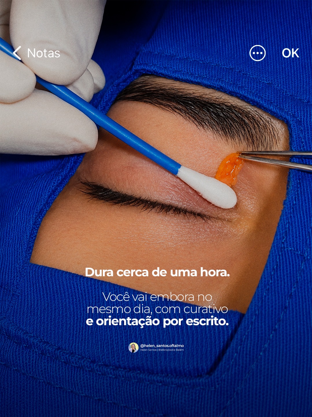 Peça 3