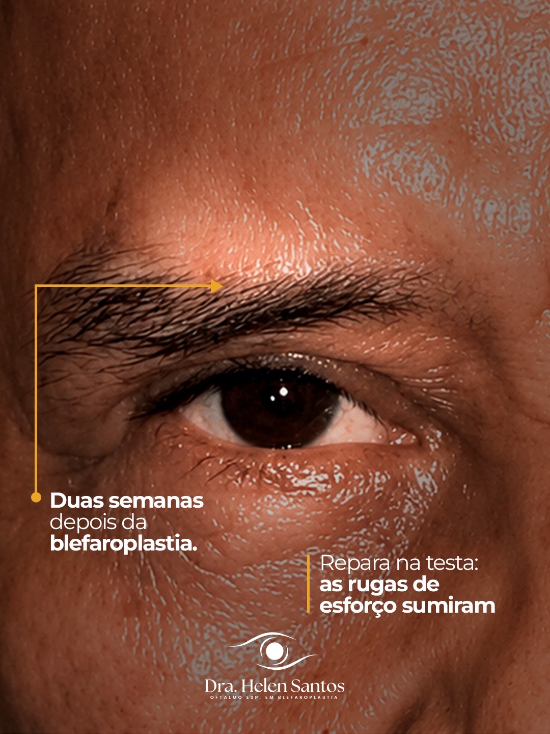 Peça 3