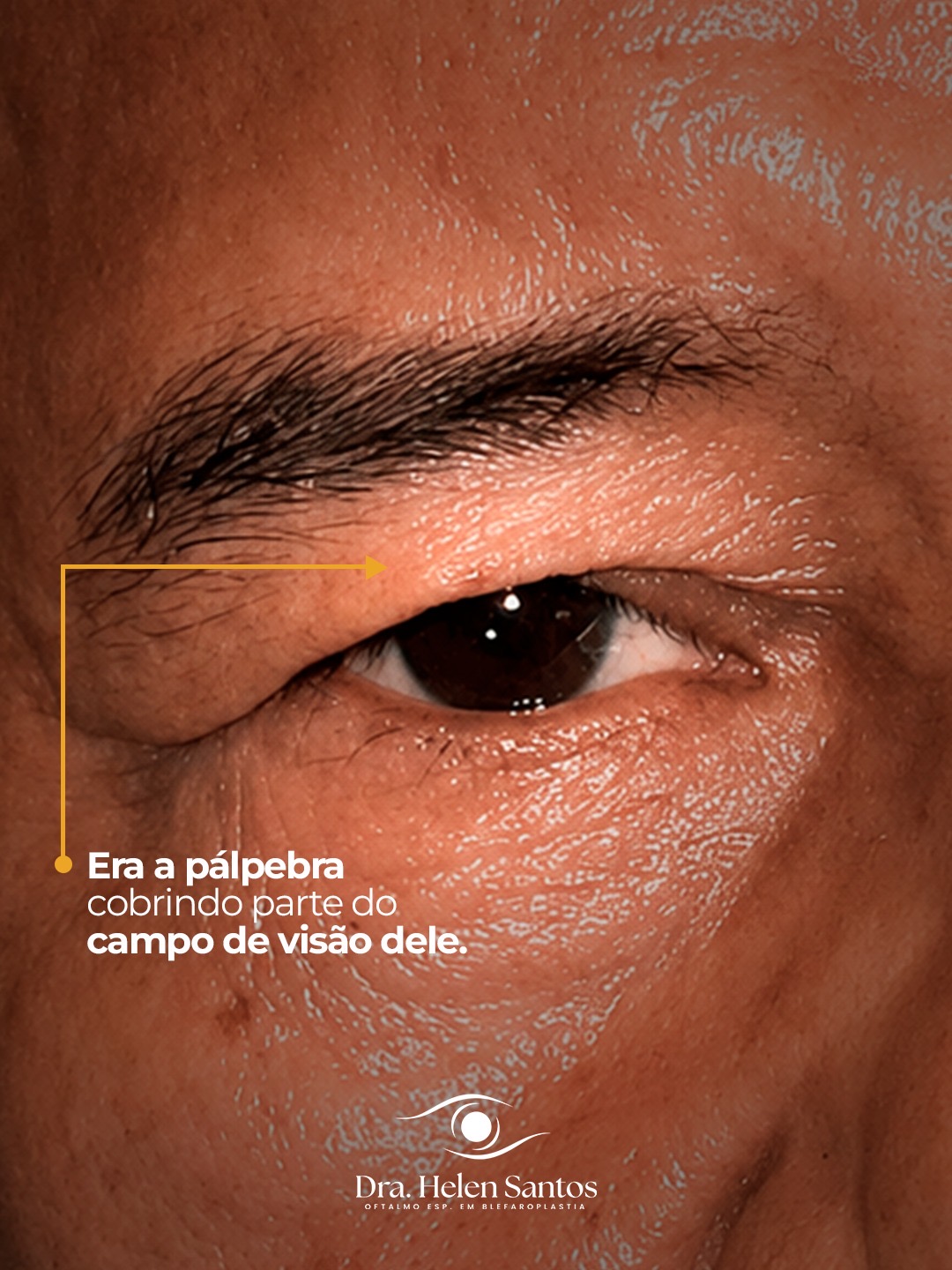 Peça 2