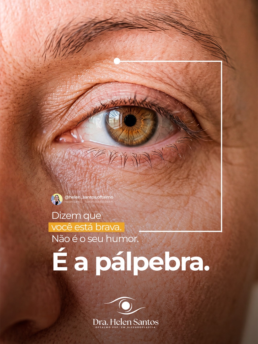 Peça 1