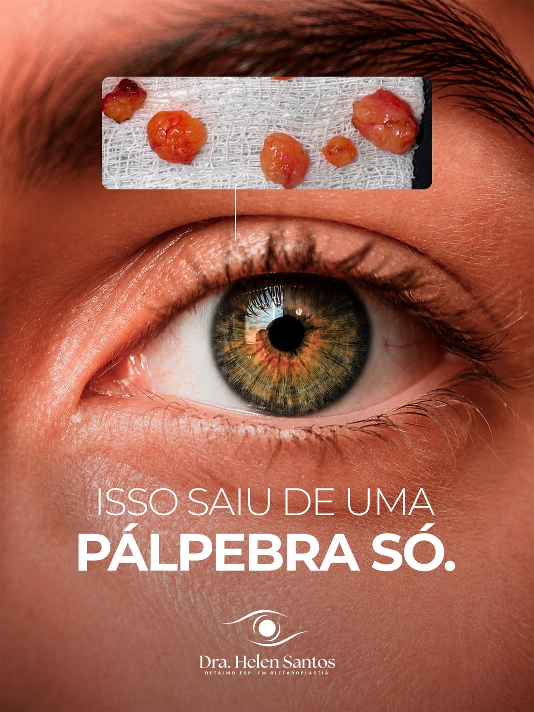 Peça 1