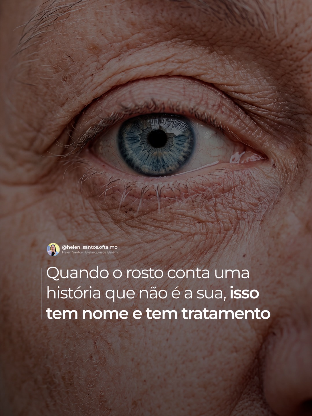 Peça 2